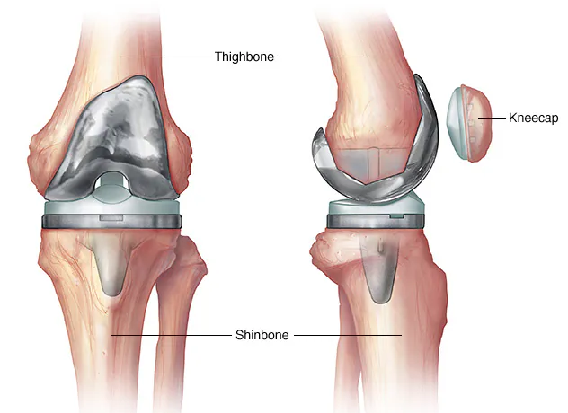 image_20260113_212430_0000