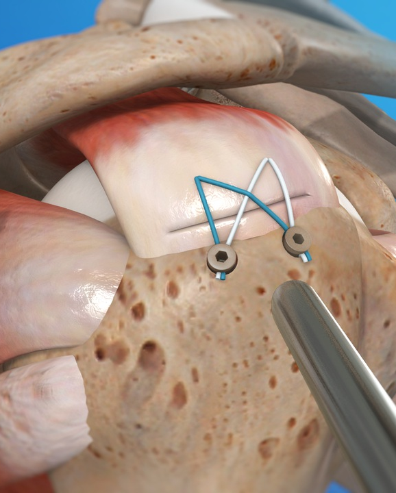 image_20260113_212435_0000