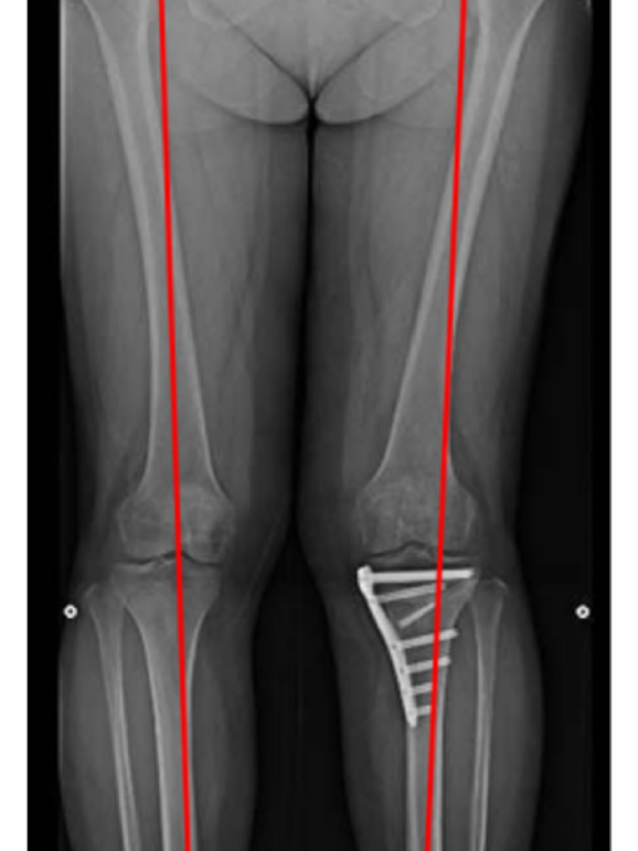 image_20260113_212440_0000