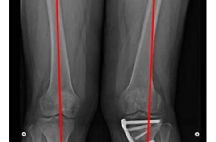 image_20260113_212440_0000