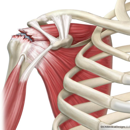 image_20260113_212346_0000